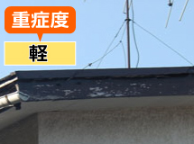 重症度：軽